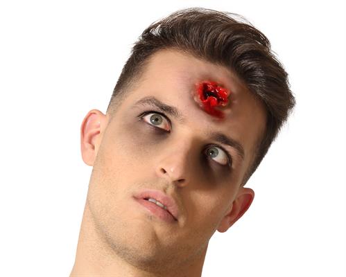 CICATRICE FORO IN FRONTE