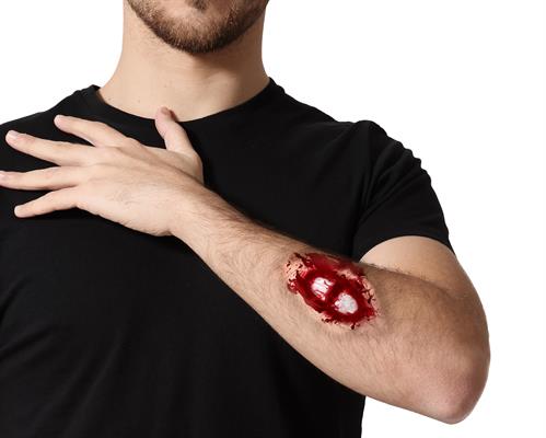 CICATRICE OSSO ESPOSTO 19X10CM